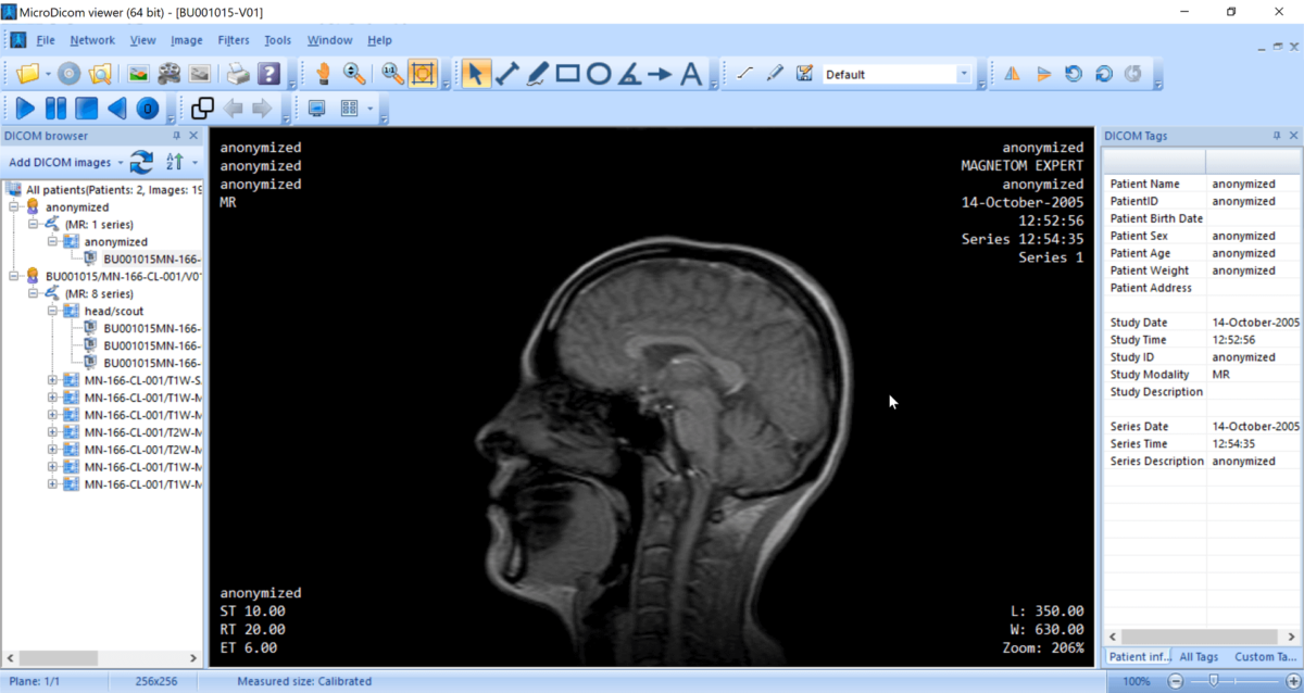 DICOM viewer Windows