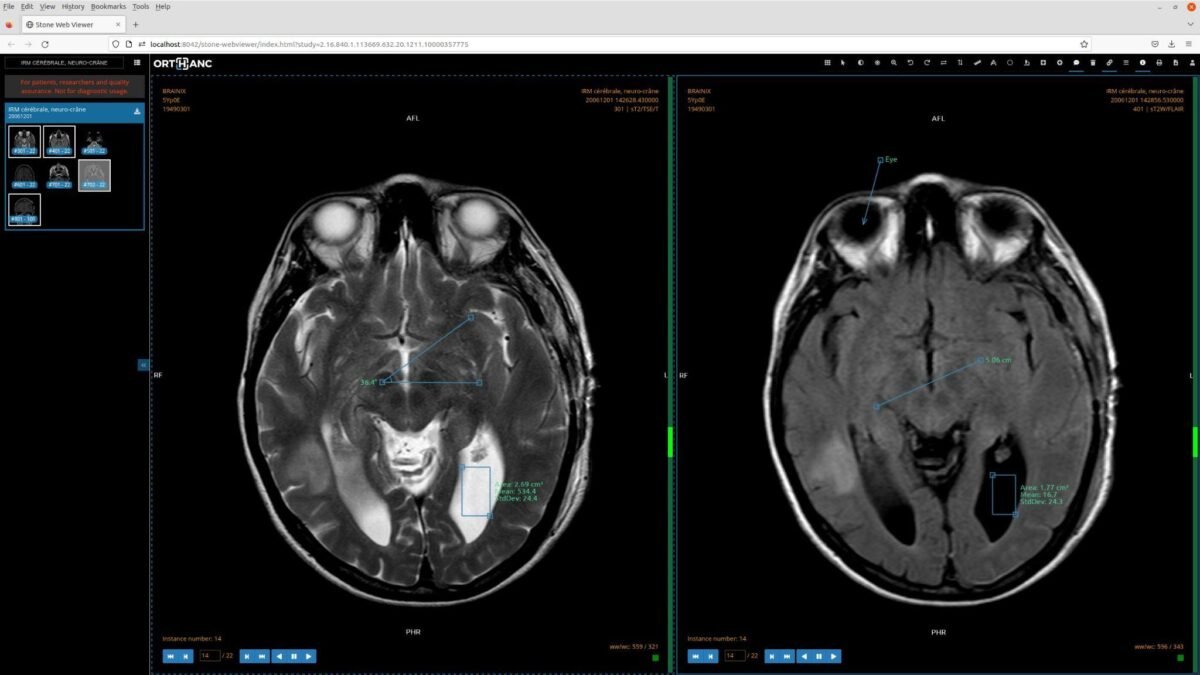 web DICOM viewer