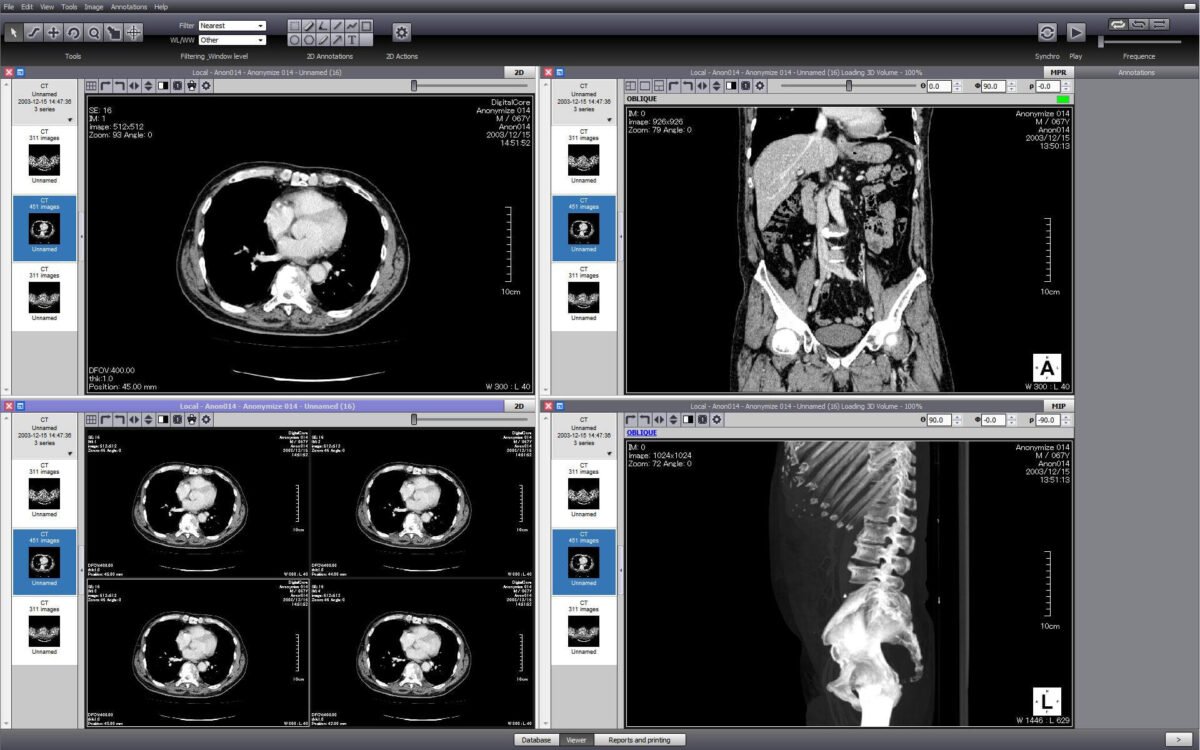 web DICOM viewer